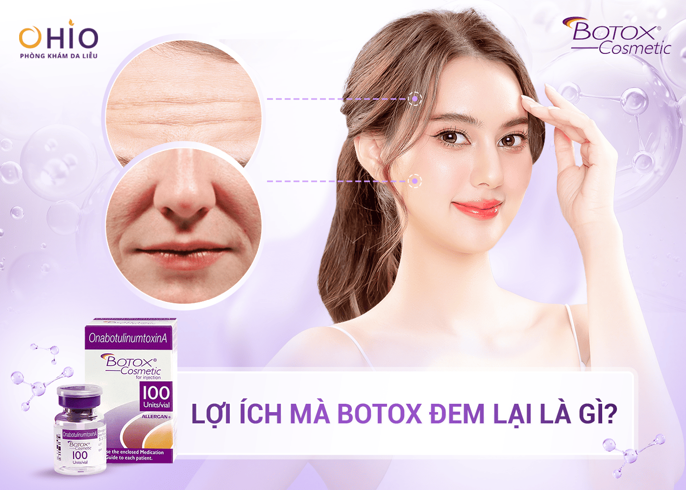 Trẻ Hóa Với Công Nghệ Cấy Tinh Chất Allergan – Giải Pháp An Toàn Và Hiệu Quả - Phòng khám da liễu OHIO Lợi ích trẻ hoá bằng tinh chất
