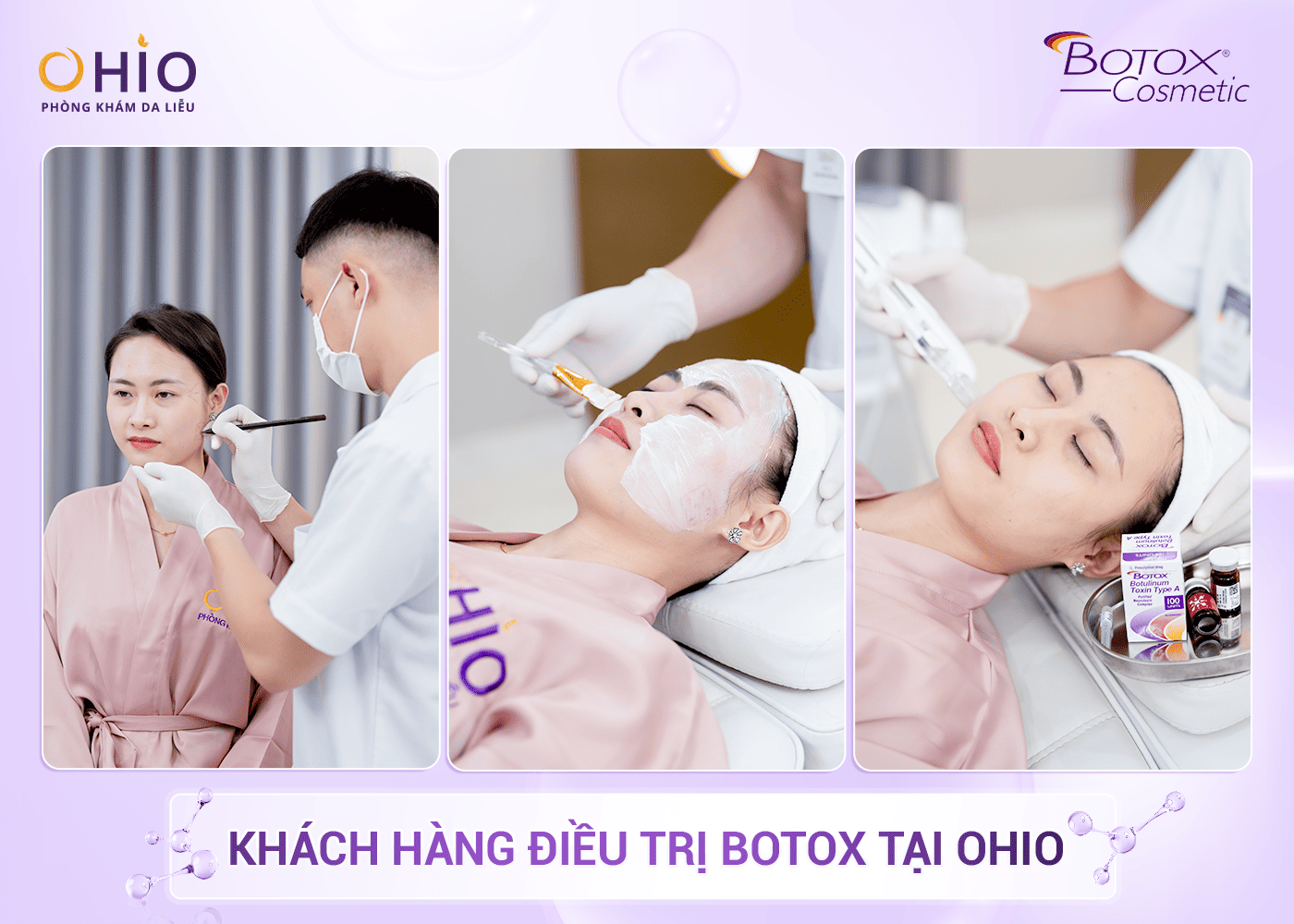 Trẻ Hóa Với Công Nghệ Cấy Tinh Chất Allergan – Giải Pháp An Toàn Và Hiệu Quả - Phòng khám da liễu OHIO Quy trình điều trị chuẩn y khoa OHIO