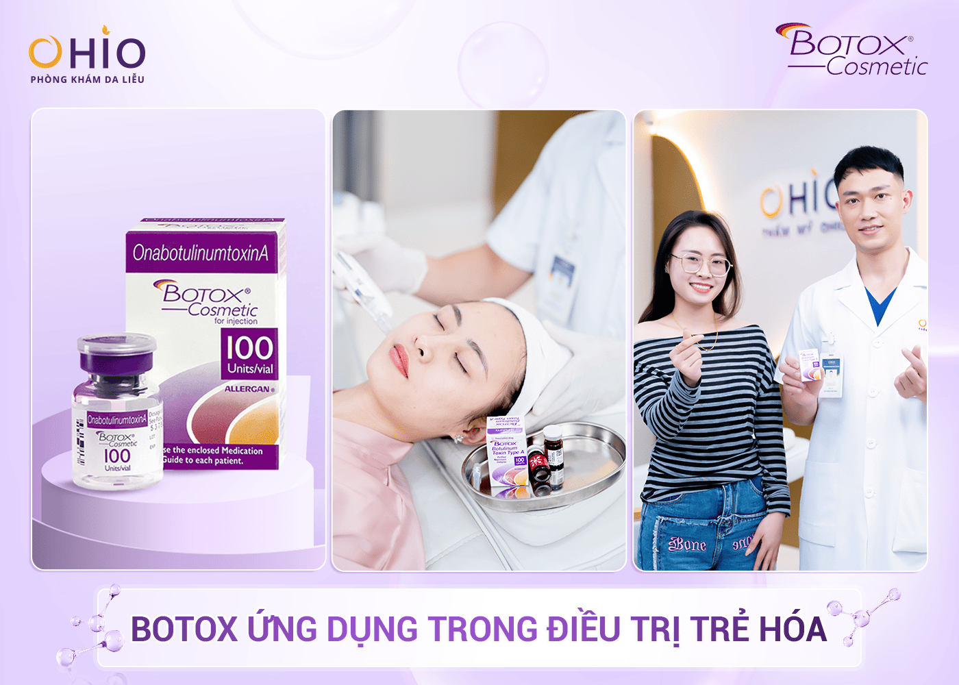 Trẻ Hóa Với Công Nghệ Cấy Tinh Chất Allergan – Giải Pháp An Toàn Và Hiệu Quả - Phòng khám da liễu OHIO Công nghệ điều trị trẻ hoá
